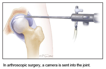 camera use in arthroscopic surgery